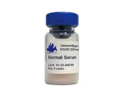 Blocking and Control Sera - Human Serum, ImmunoReagents