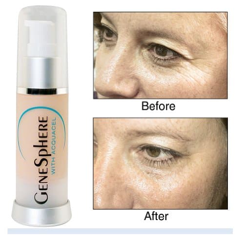 Genesphere with Acquacel by Biologic Solutions (New Version) by Biologic Solutions