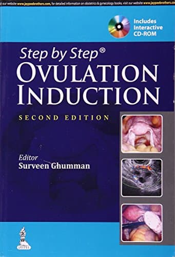 Step by Step Ovulation Induction