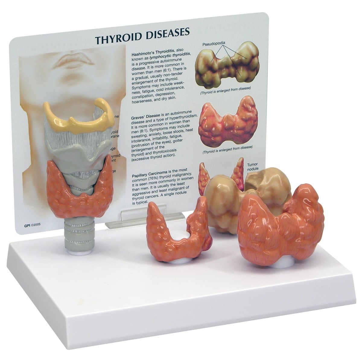 3B Scientific Thyroid Model