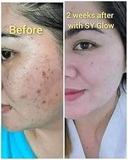 SY Glow Rejuvenating Set