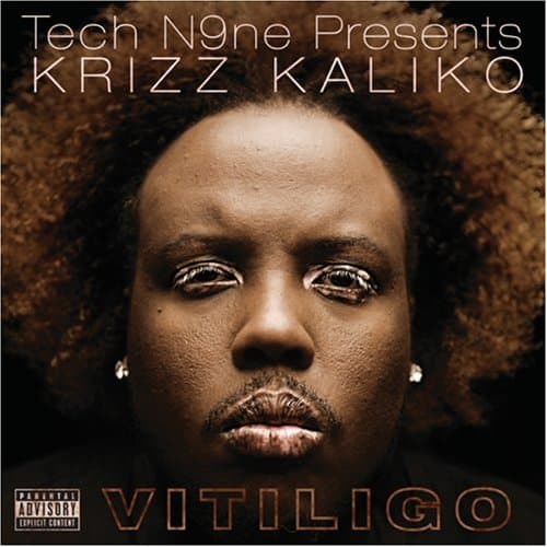 Vitiligo       explicit_lyrics