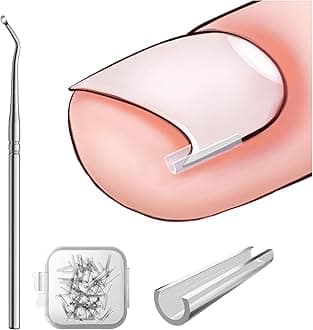 BEZOX Ingrown Toenail Corrector Set - 40 Pcs Pain-Free Toenails Straightener Strips with Toe Nail Lifter - Easy Use Ingrown Toenail Tools Kit