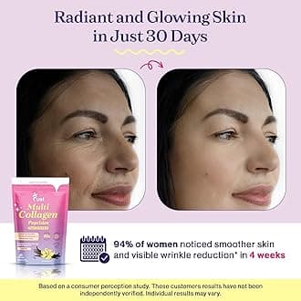 Fuel Multi Collagen Peptides Powder – 20g Hydrolyzed Collagen I, II, III, V & X for Hair, Skin, Nails & Joint Support – Better Absorption – Keto & Gluten Free, French Vanila 8.67oz