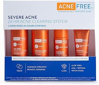 AcneFree 4 Step Severe Acne Treatment Kit - Benzoyl Peroxide Face Wash, Witch Hazel Toner, 10% Benzoyl Peroxide Lotion & Retinol PM Complex - Prime Solution For Teens & Adults with Severe Acne
